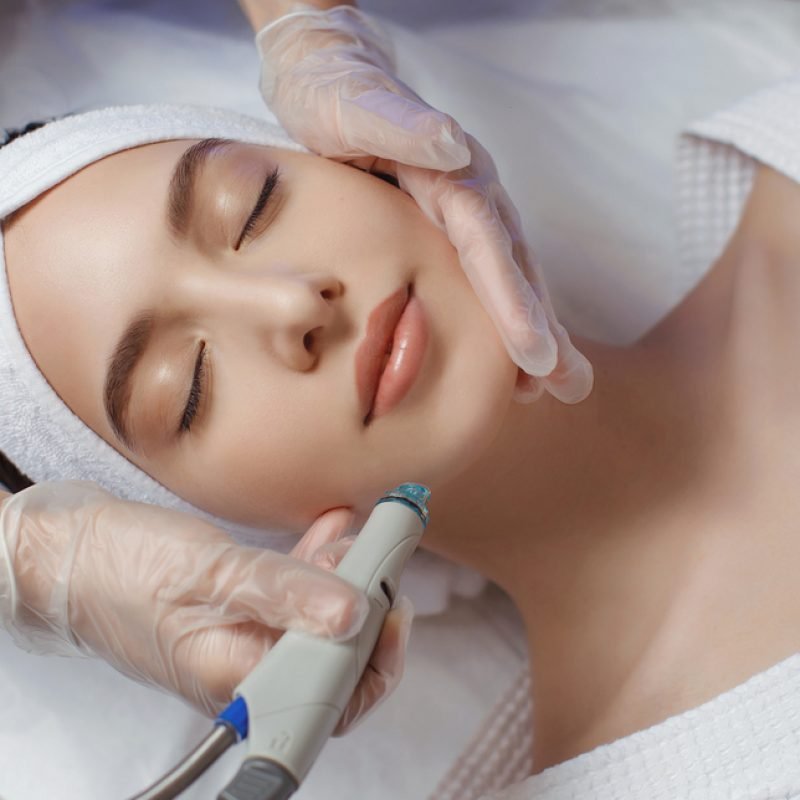 Side view of woman receiving microdermabrasion therapy on forehead at beauty spa. Hydrafacial procedure in Cosmetology clinic.